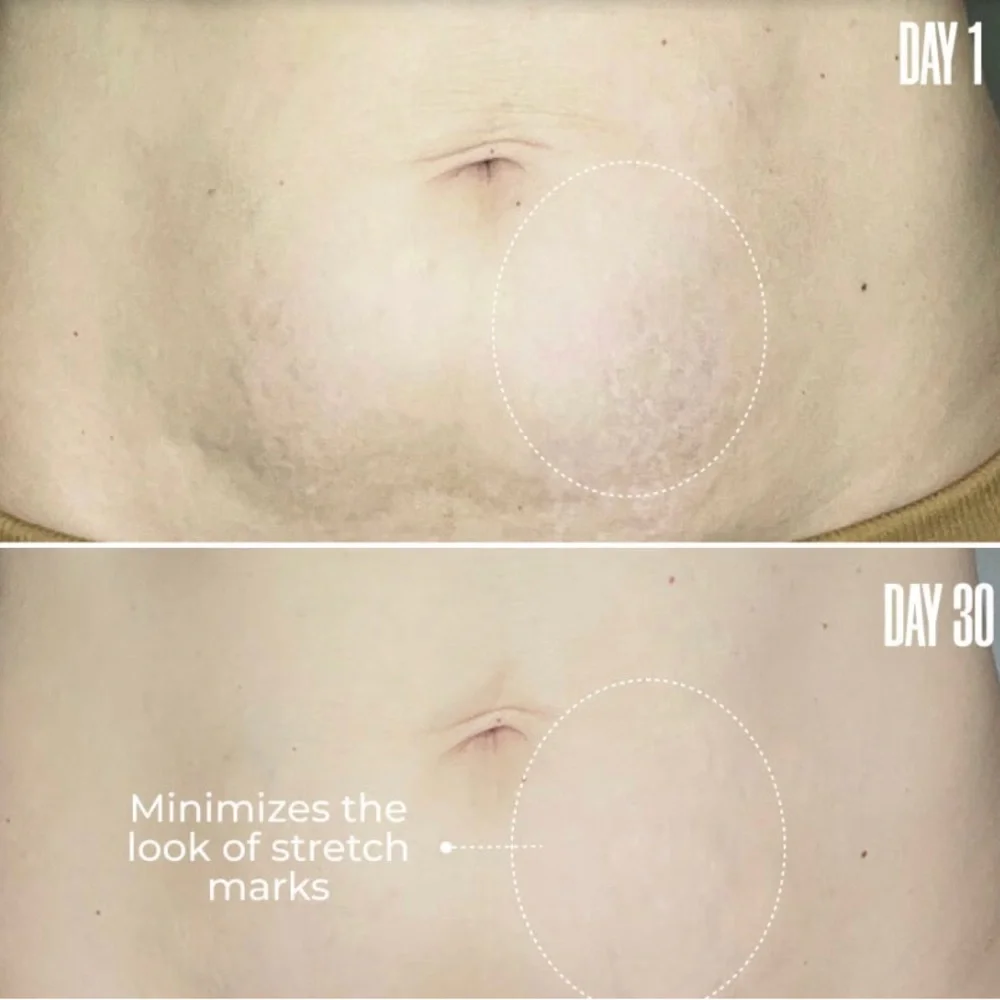 Maëlys Re-Lure Tight & Tone Body Serum